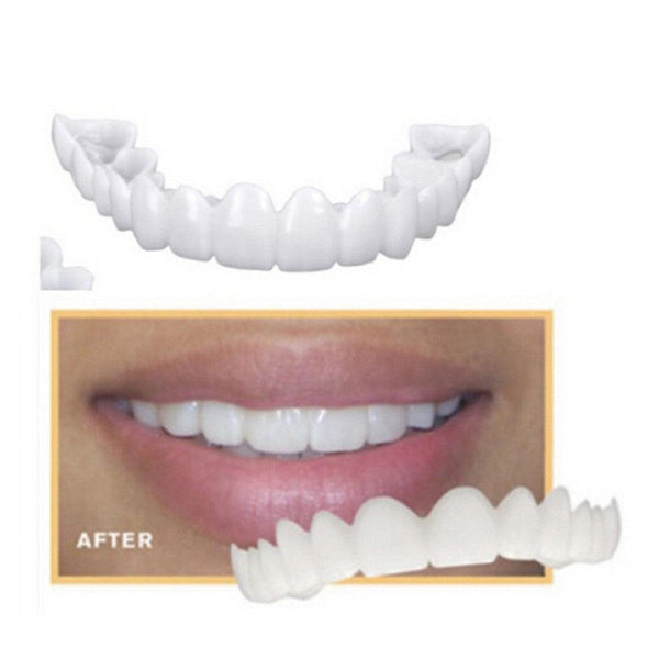 Glamza Get Set Smile Veneers 4