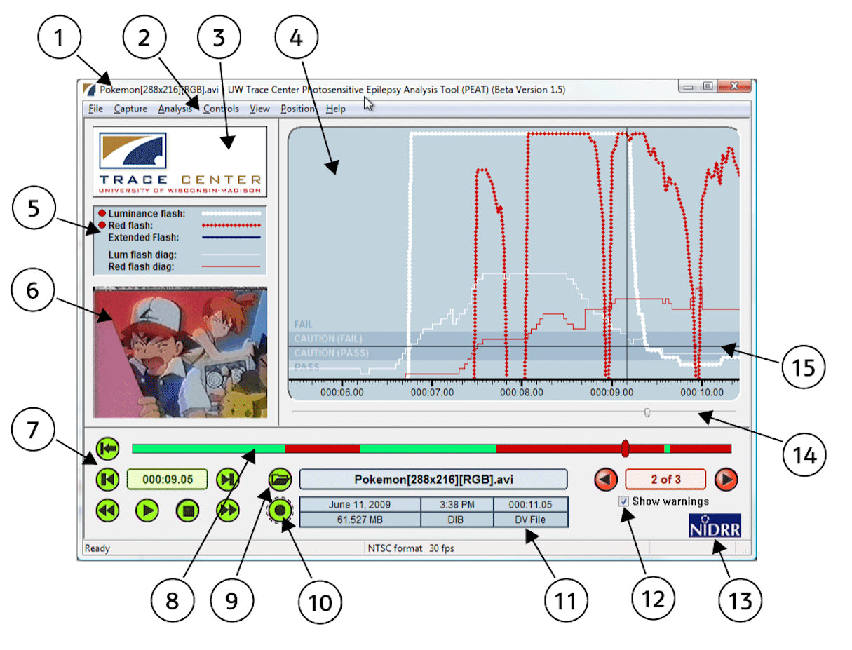 Photosensitive Epilepsy Analysis Tool