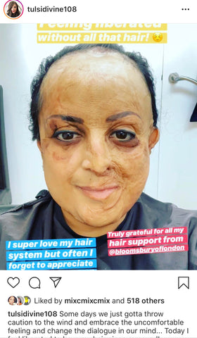 Tulsi's Instagram post without hair system