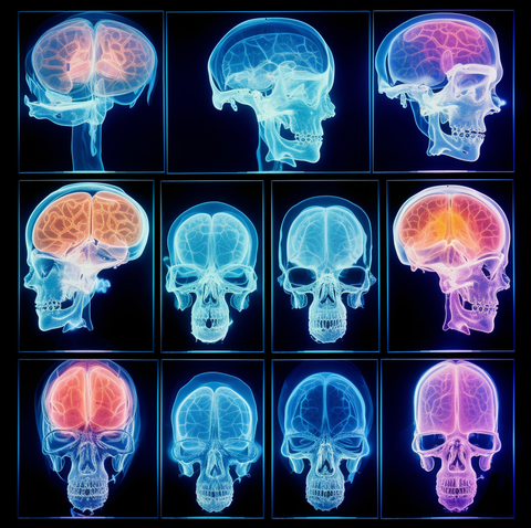 brain scans - skeleton keys