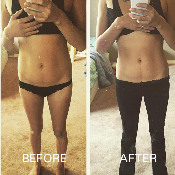 Teens Skinny Results 93