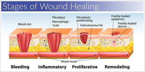 Wound healing stages
