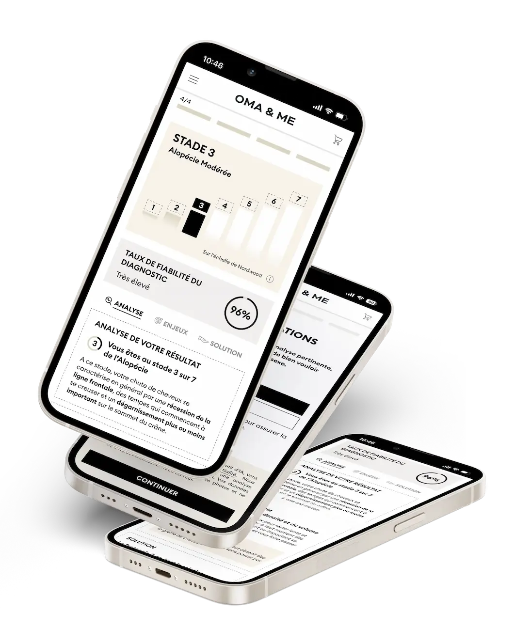 Three smartphones displaying an app interface for hair loss diagnosis and solutions.