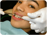 Image of person with braces having teeth checked. Inform all healthcare professionals if you have a nickel allergy.