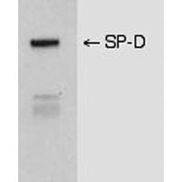 Anti-SP-D - Mouse (2D12-A-88)