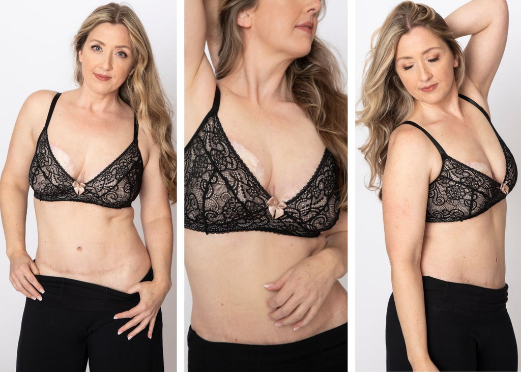 Gloria pocketed lace bralette on implant reconstruction model anaono