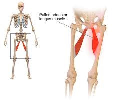 adductor muscles groin strain