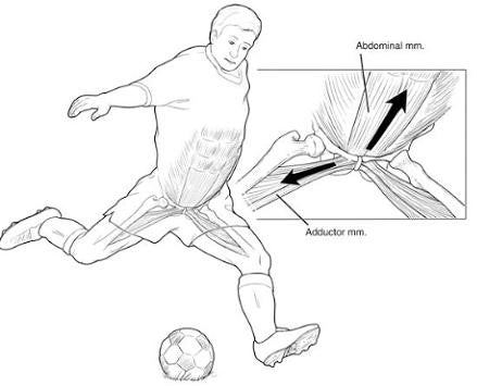 football injuries osteitis pubis 