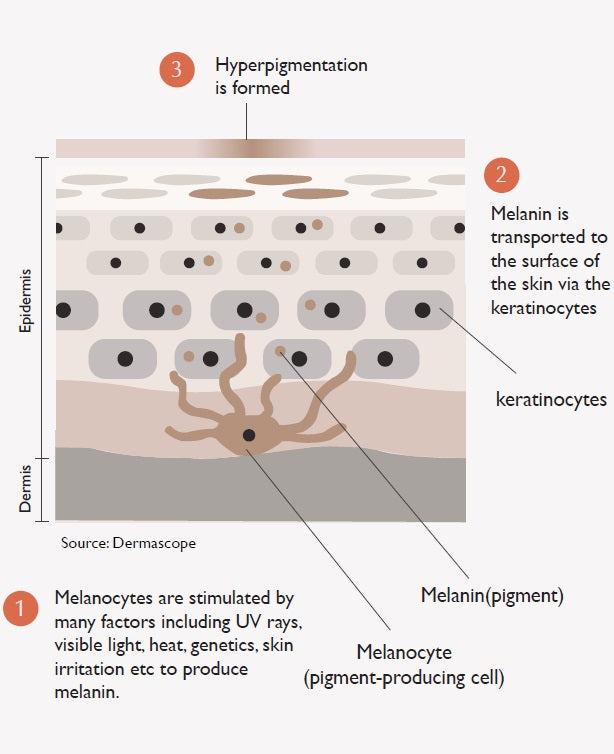 Process of hyperpigmentation in skin layers
