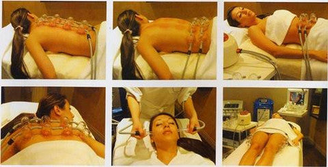 Cupping massage therapy muscle relaxer – 7STAR