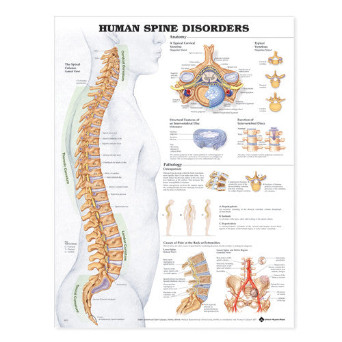 THE HUMAN SPINE - DISORDERS | acudepot