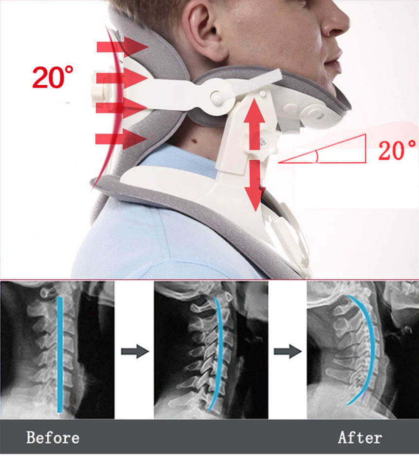 Cervitrax Cervical Traction Collar