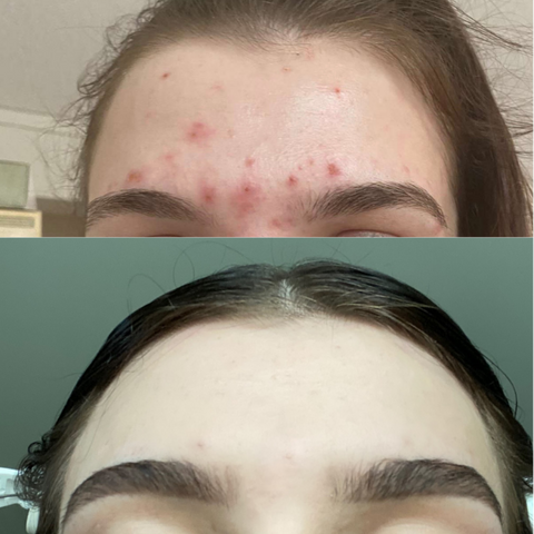 The Facial Room Eminence Organics COOLA Before and After Results