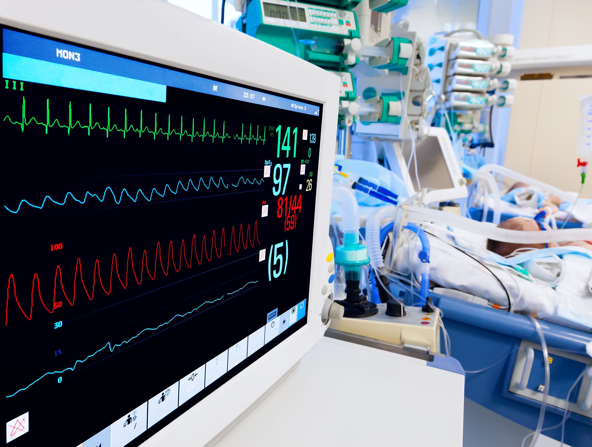 BioMedical-Patient Monitors