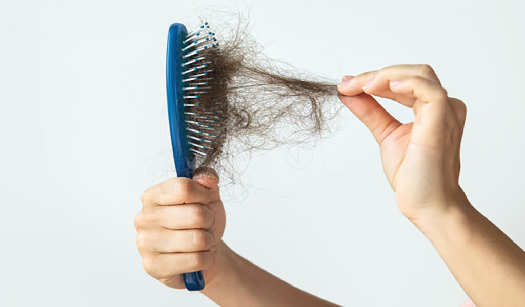 Here's How Stress Causes Hair Loss – Wellbeing Nutrition