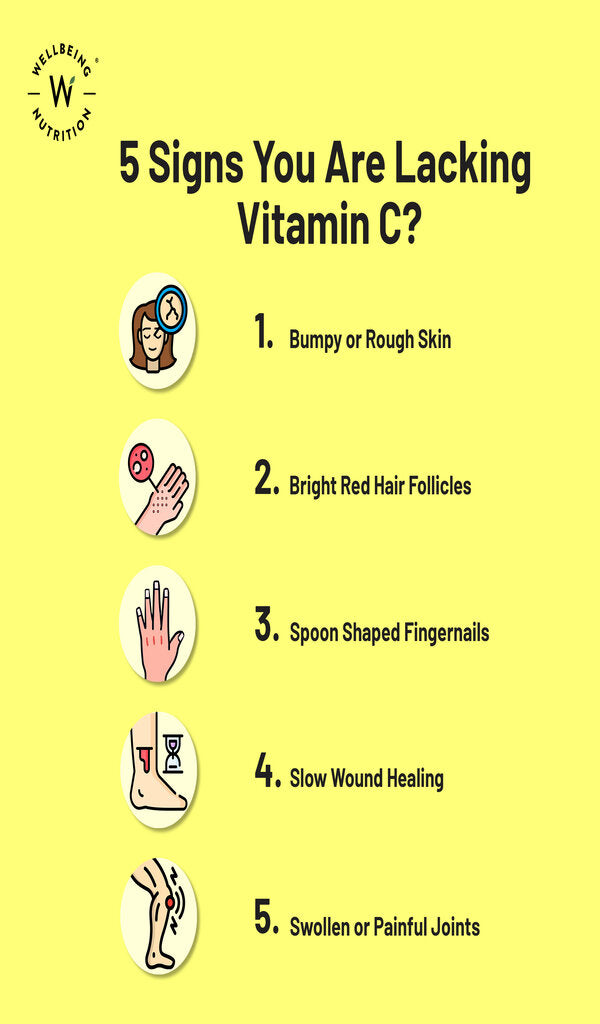 What Vitamin Am I Lacking If My Joints Hurt? Discover The Answers!