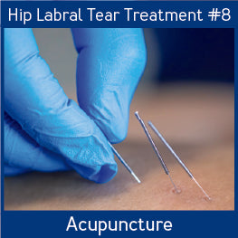 Hip Labral Tear Treatments_Acupuncture.jpg__PID:86ae311c-998a-43a0-a72d-a86a86225b00