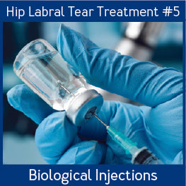 Hip Labral Tear Treatments_Biological Injections.jpg__PID:ae311c99-8ab3-4067-ada8-6a86225b00d3