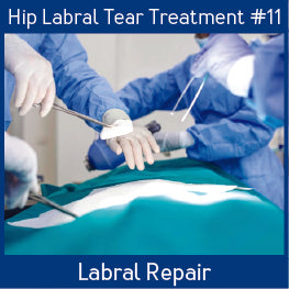 Hip Labral Tear Treatments_Labral Repair.jpg__PID:5b2364f6-548d-46ae-b11c-998ab3a0672d