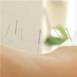 A close up of various acupuncture needles inserted in a person's piriformis muscle