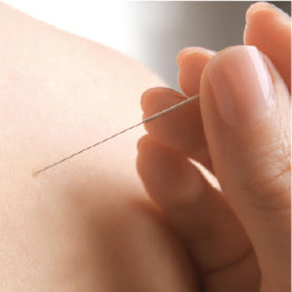 A close up of a person inserting a needle into a person's piriformis muscle