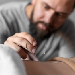 Close up of needles being placed for acupuncture