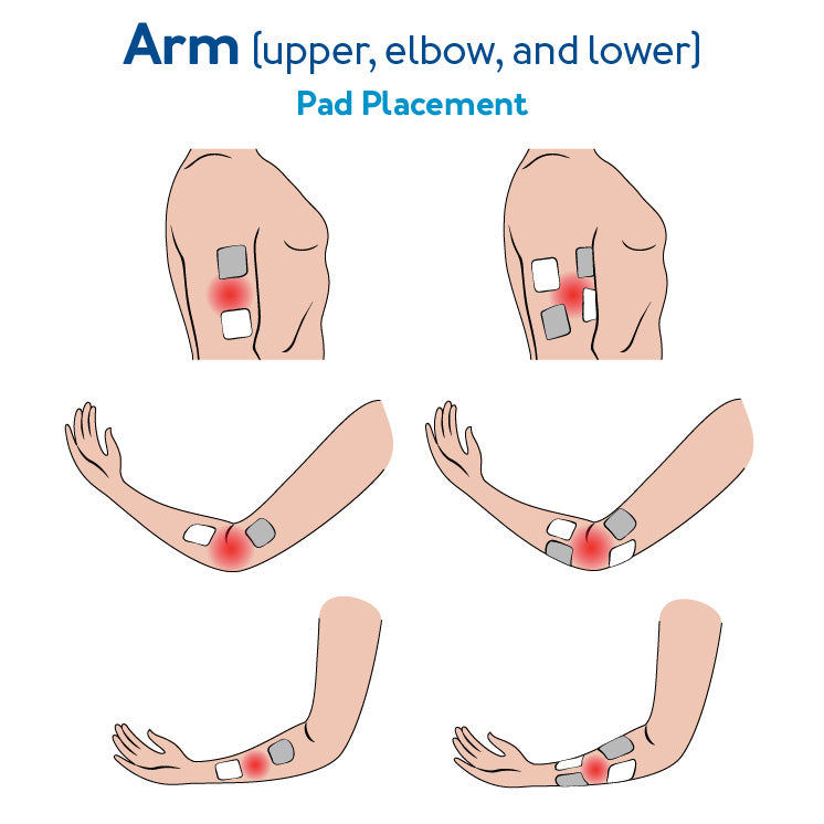 TENS Unit Arm Placement - Upper, Elbow, and Lower Arm