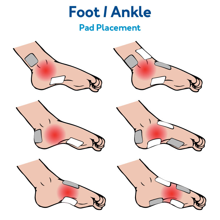 TENS Unit Foot/Ankle Placement