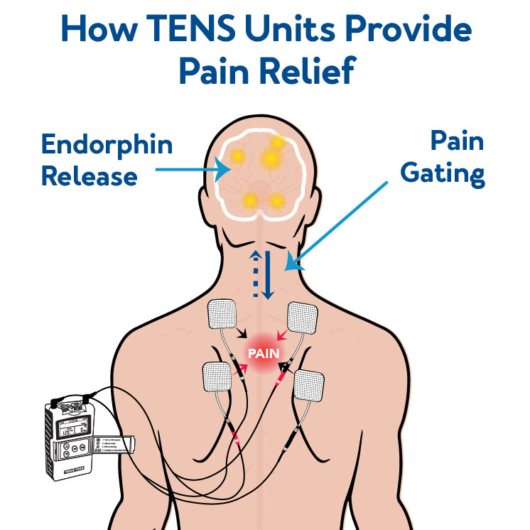  TENS 7000 Digital TENS Unit with Accessories - TENS Unit Muscle  Stimulator for Back Pain Relief, Shoulder Pain Relief, Neck Pain, Sciatica  Pain Relief, Nerve Pain Relief : Health & Household