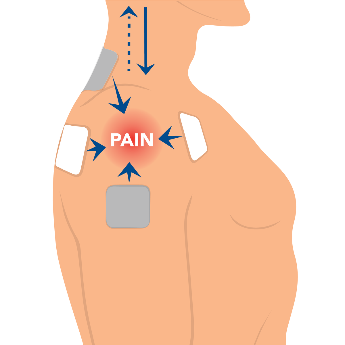 A graphic of a man with TEND pads on his shoulder