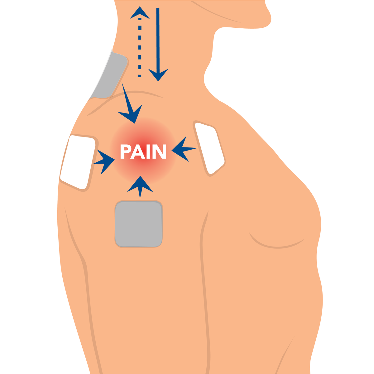 How to Cope with End-Stage Arthritis Shoulder and How Red Light