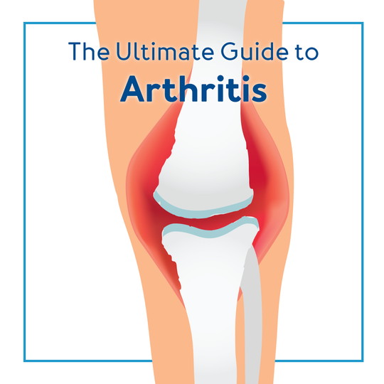 Graphic of knee and bones with red and text “The Ultimate Guide to Arthritis”