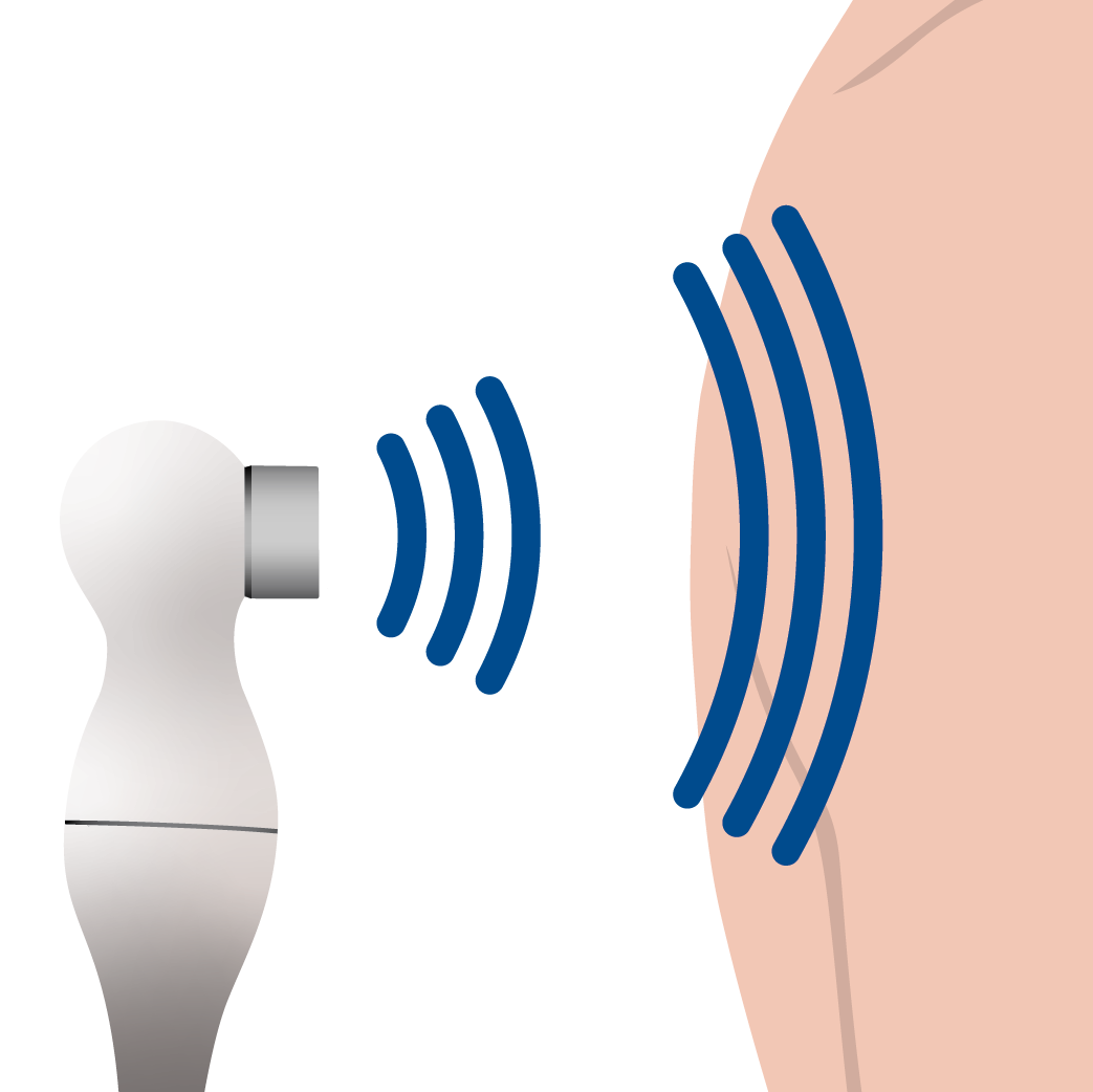 A graphic of a mechanical ultrasound therapy device being used on skin