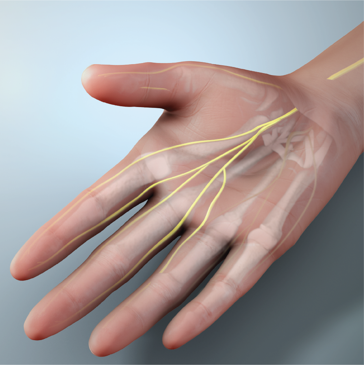 A graphic of a hand and pain nerves showing