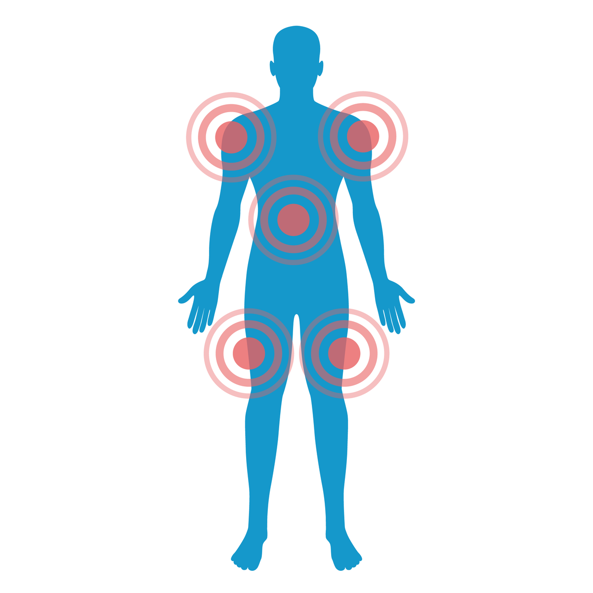 A graphic of a human body with red marks showing pain