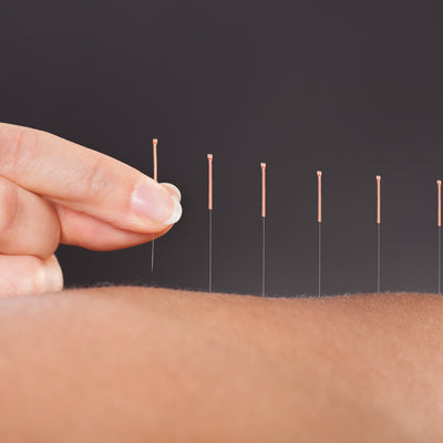 Close up of acupuncture needles in skin