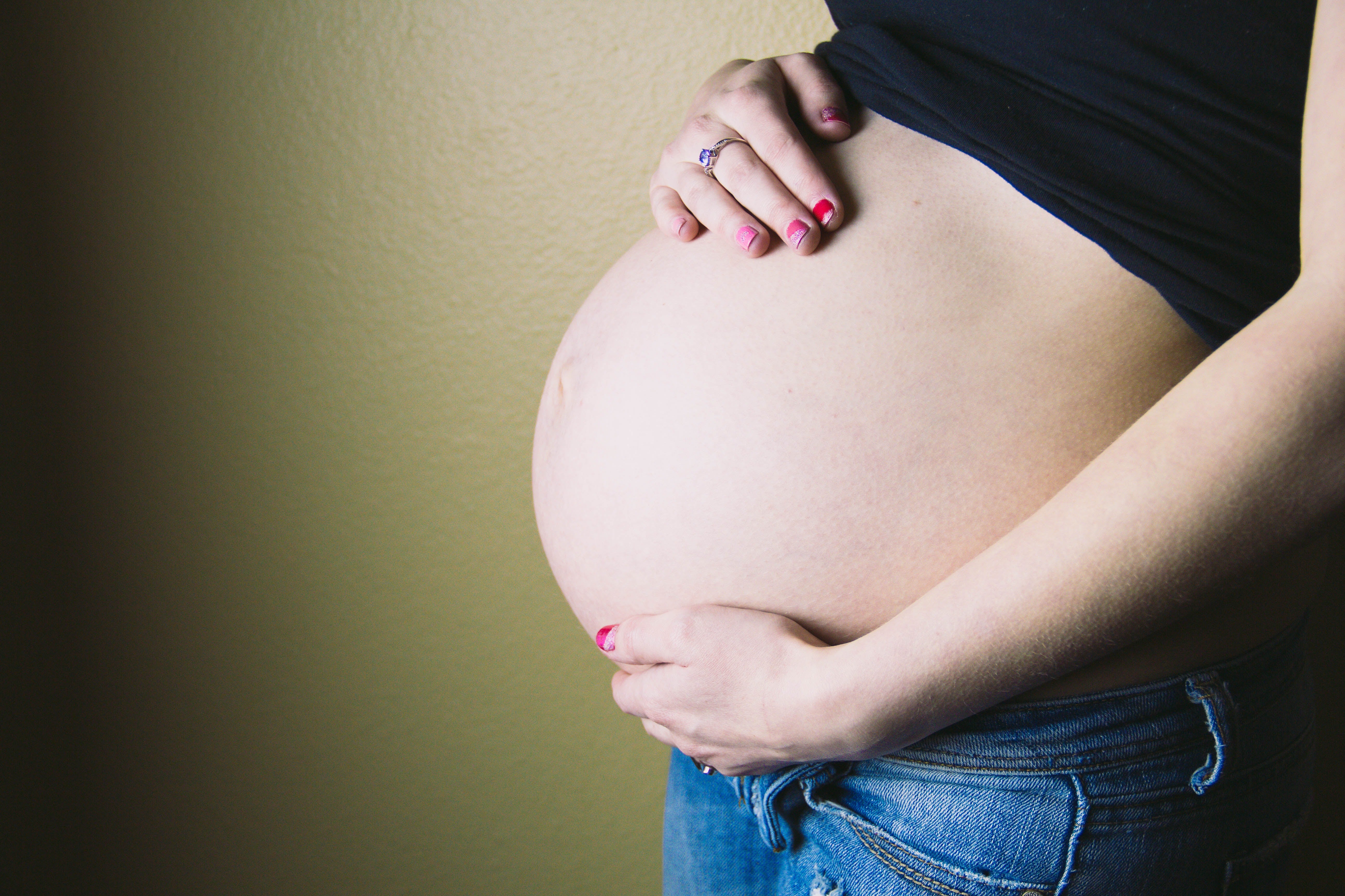 Taping Techniques to Alleviate Pregnancy Pain