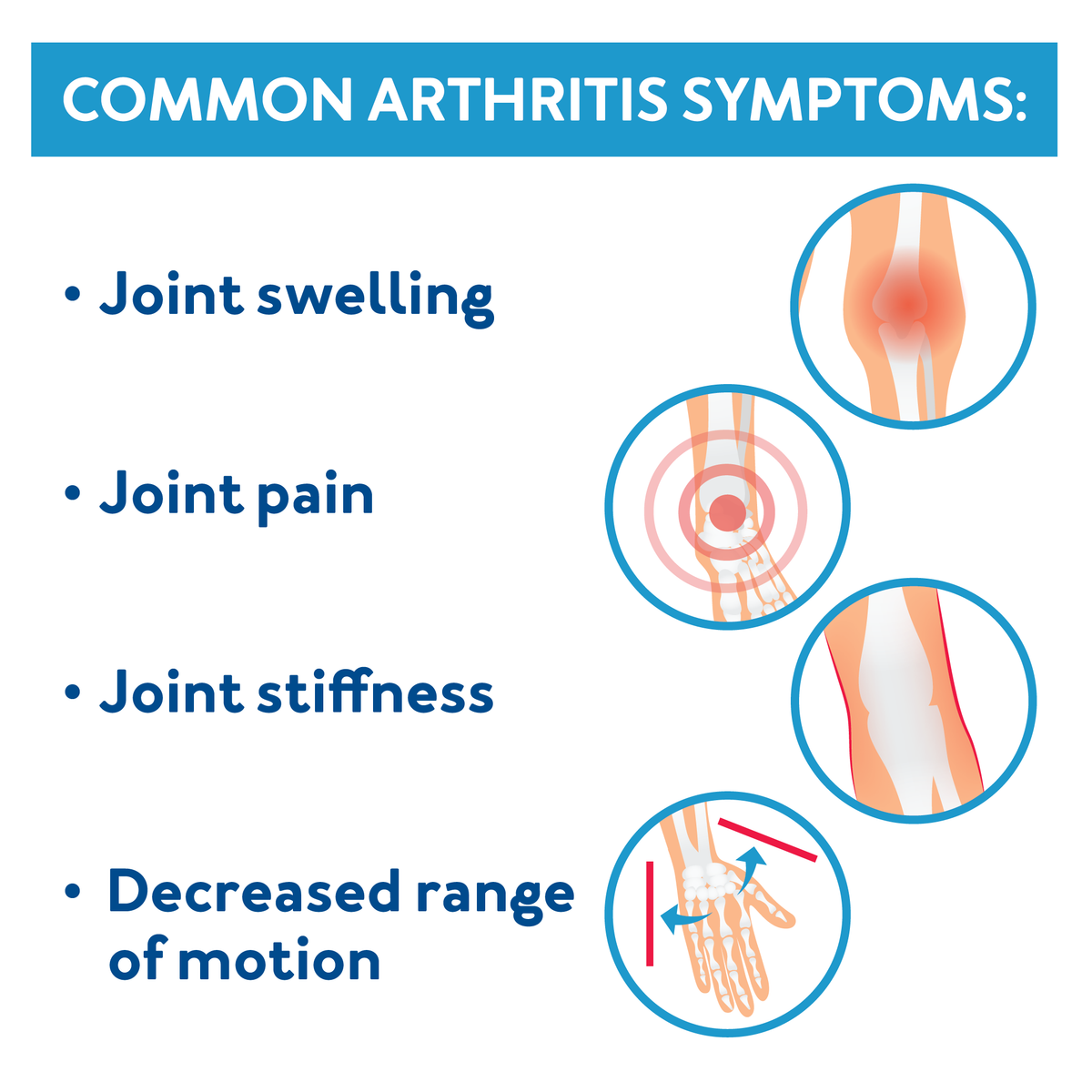 Common Arthritis Symptoms : Joint Swelling Joint Pain Joint Stiffness Decreased range of motion