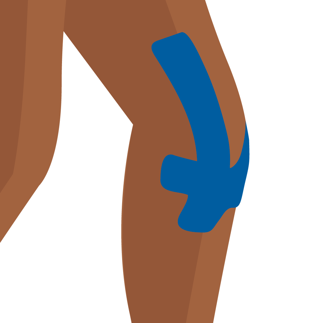 A graphic of kinesiology tape on a person’s knee