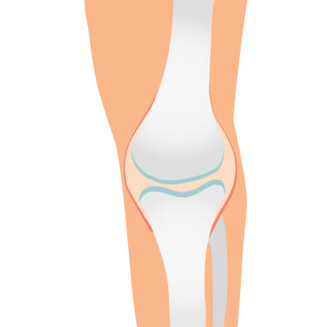 A graphic of a knee showing the bone inside