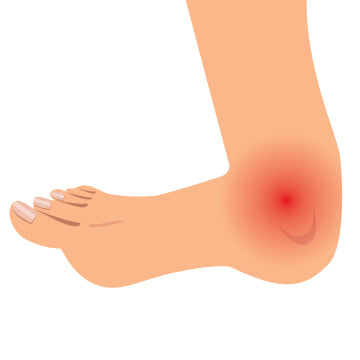 A graphic of an angle with red for pain