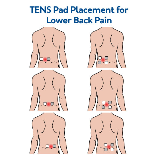 TENS Therapy for Back Pain– Carex