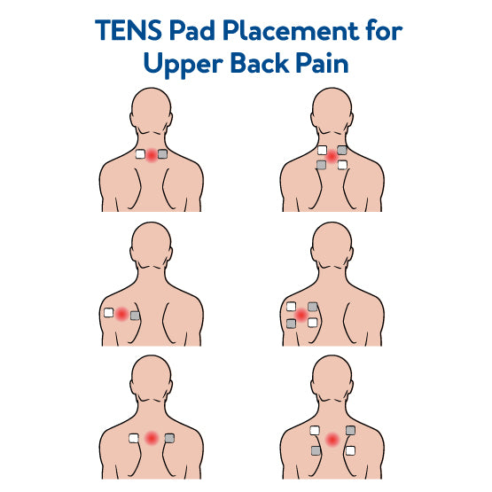 A graphic of various pad placements for upper back pain. Text, TENS pad placement for upper back pain