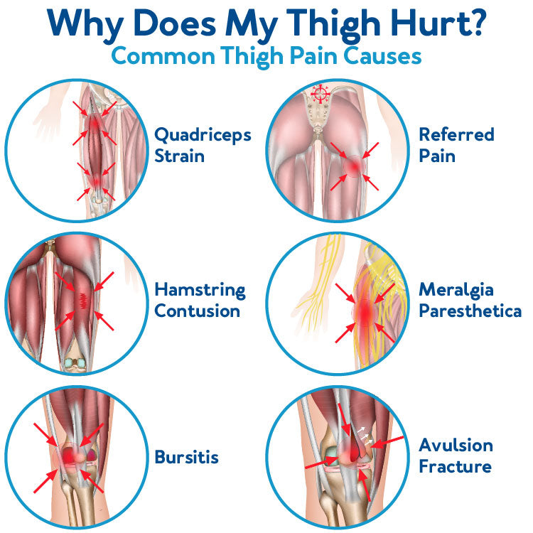 why-is-your-thigh-in-pain-6-common-causes-carex