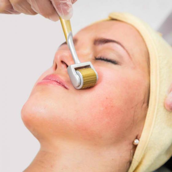 derma roller utone