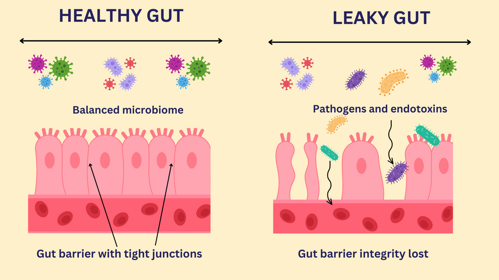 Healthy Gut vs Leaky Gut