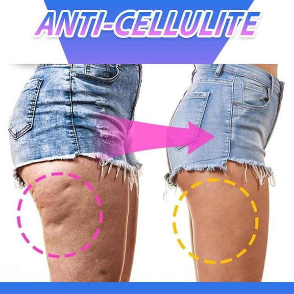 Anti-Cellulite 4D Shaping Compression Leggings - Hale Kūʻai Molooco  Pūnaewele