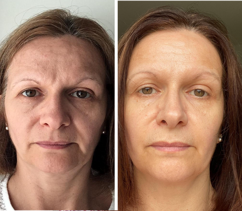 Vegan Collagen before and after