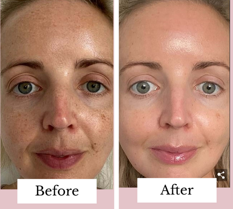 Vegan Collagen before and after