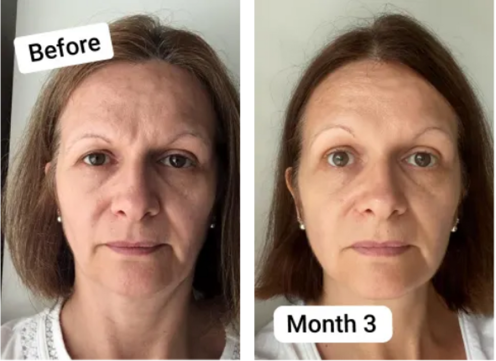 Vegan Collagen Before and After